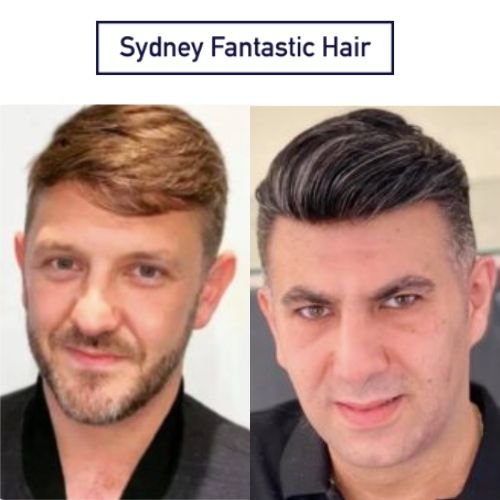Wigs at Sydney Fantastic Hair, NSW, Australia.